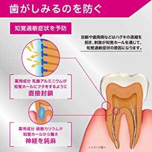 GUM ガム プロケア ハイパーセンシティブ 知覚過敏 知覚ホールフッ素 1450ppm ハミガキ 歯磨き 