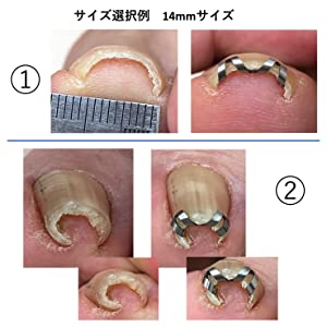 ネイルエイドのサイズ選択例　１４ｍｍ