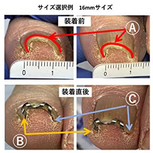 ネイルエイドのサイズ選択例１６ｍｍサイズ