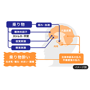 乗り物酔いとは？