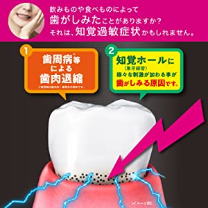 GUM ガム プロケア ハイパーセンシティブ 知覚過敏 知覚ホールフッ素 1450ppm ハミガキ 歯磨き 