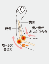 ザムスト ひじサポーター エルボーバンド