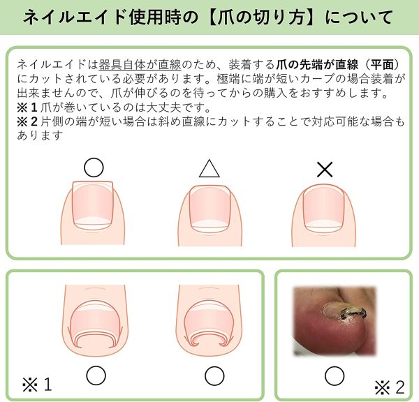 ネイルエイド 16㎜ 巻き爪 矯正 自分で 巻きづめ ワイヤー クリップ - 画像 (2)